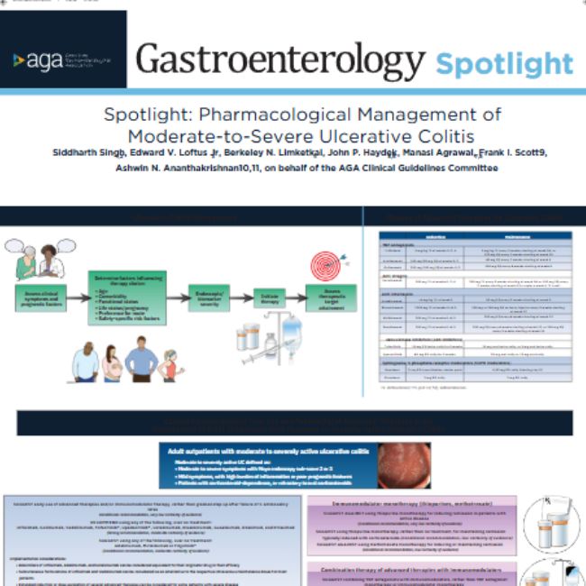 Ulcerative colitis guideline: Spotlight infographic